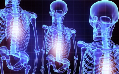 osteoporosis - skeletons